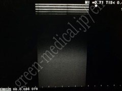 Hitachi Ultrasound Color Doppler