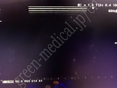 Hitachi Ultrasound Color Doppler
