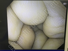 OLYMPUS Video System Center