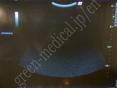 GE Healthcare Ultrasound Color Doppler