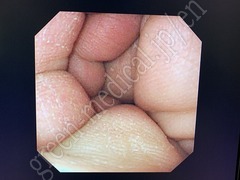 OLYMPUS Video Gastroscope