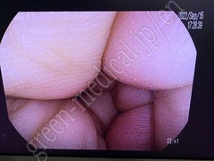 PENTAX Video Colonoscope