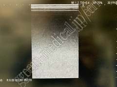 Hitachi Ultrasound Diagnostic System