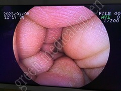 FUJIFILM Video Colonoscope