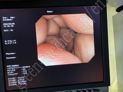 OLYMPUS Video Colonoscope