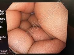 OLYMPUS Video Gastroscope