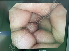 OLYMPUS Video Colonoscope