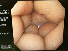 OLYMPUS Video Gastroscope