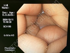 OLYMPUS Video Gastroscope