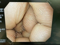 OLYMPUS Gastrointestinal Videoscope