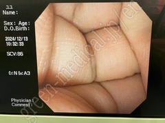OLYMPUS Video Duodenoscope