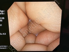 OLYMPUS Video Gastroscope