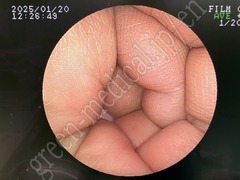 FUJIFILM Video Gastroscope