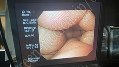 OLYMPUS Video Gastroscope