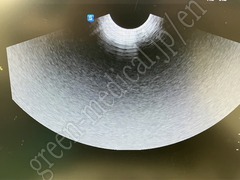 SAMSUNG Ultrasound Color Doppler
