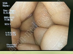 OLYMPUS Video Gastroscope