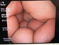 OLYMPUS Video Gastroscope