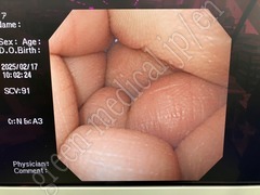 OLYMPUS Video Gastroscope