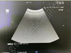 Hitachi Ultrasound Color Doppler