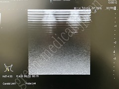 Hitachi Ultrasound Diagnostic System
