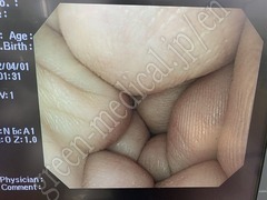 OLYMPUS Video Gastroscope