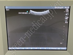 SonoSite Portable Ultrasound Color Doppler