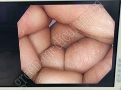 OLYMPUS Processor & Xenon Lightsource