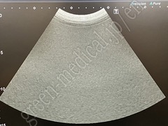TOSHIBA Ultrasound Color Doppler