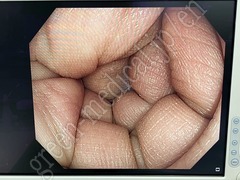 OLYMPUS Video Colonoscope (Long)