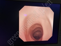 OLYMPUS Video Duodenoscope