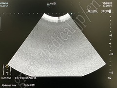 Hitachi Diagnostic  Ultrasound System