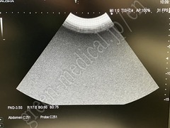 Hitachi Ultrasound Diagnostic System