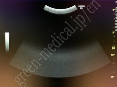 GE Healthcare Ultrasound Color Doppler