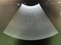 TOSHIBA Diagnostic Ultrasound System