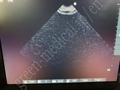 SonoSite Ultrasound Color Doppler