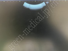 GE Healthcare Diagnostic Ultrasound System