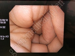 OLYMPUS Video Gastroscope