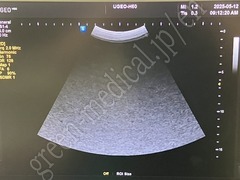 SAMSUNG Ultrasound Color Doppler