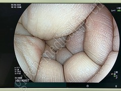 FUJIFILM Video Gastroscope