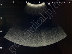 TOSHIBA Ultrasound Color Doppler