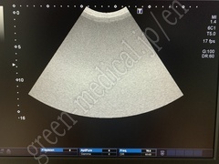 TOSHIBA Ultrasound Color Doppler