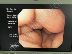 OLYMPUS Video Gastroscope