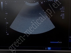 TOSHIBA Ultrasound Color Doppler