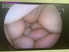 FUJIFILM Transnasal Gastroscope