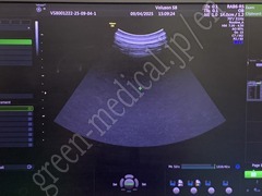 GE Healthcare Diagnostic Ultrasound System