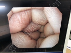 OLYMPUS Processor & Xenon Lightsource