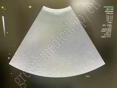 SIEMENS 4D Ultrasound System