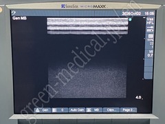 SonoSite Ultrasound Color Doppler