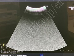 Hitachi Ultrasound Color Doppler