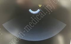 GE Healthcare Diagnostic Ultrasound System